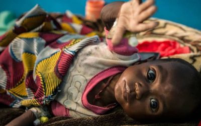 Mali : la malnutrition infantile dépasse largement les seuils critiques fixés par l’OMS